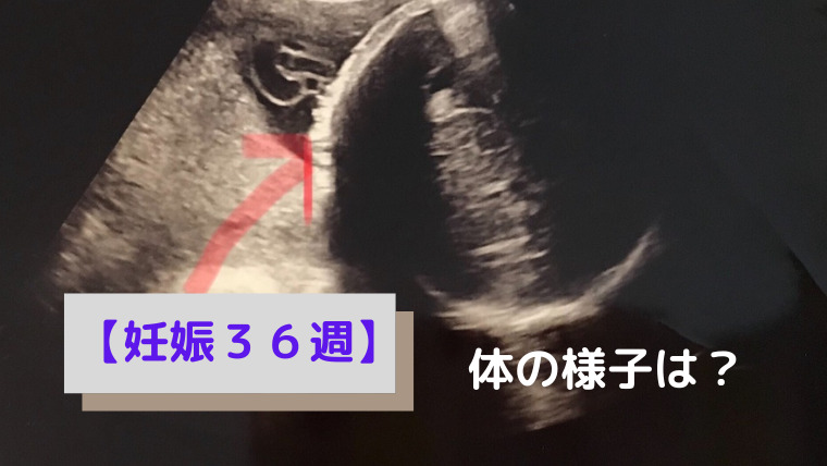 臨月 妊娠36週に突入 前駆陣痛 足の付け根の痛みに悩まされる日々 ママもよう 4児ママsakiのブログ